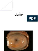 Lecture Cervix