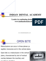 OPEN BITE 1 / Orthodontic Courses by Indian Dental Academy