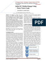 Segmentation of Medical Image Using Fuzzy Neuro Logic