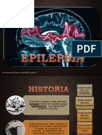 EPILEPSIAS G13.pptx