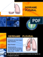 Derrame Pleural