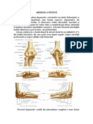 Tratamentul artrozei articulației genunchiului și cotului