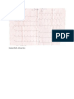 Chest Pain Ischemic Heart Disease