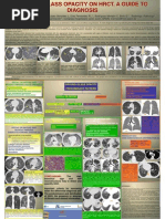 Head Cheese Sign in Hypersensitivity Pneumonitis | PDF | Respiratory ...