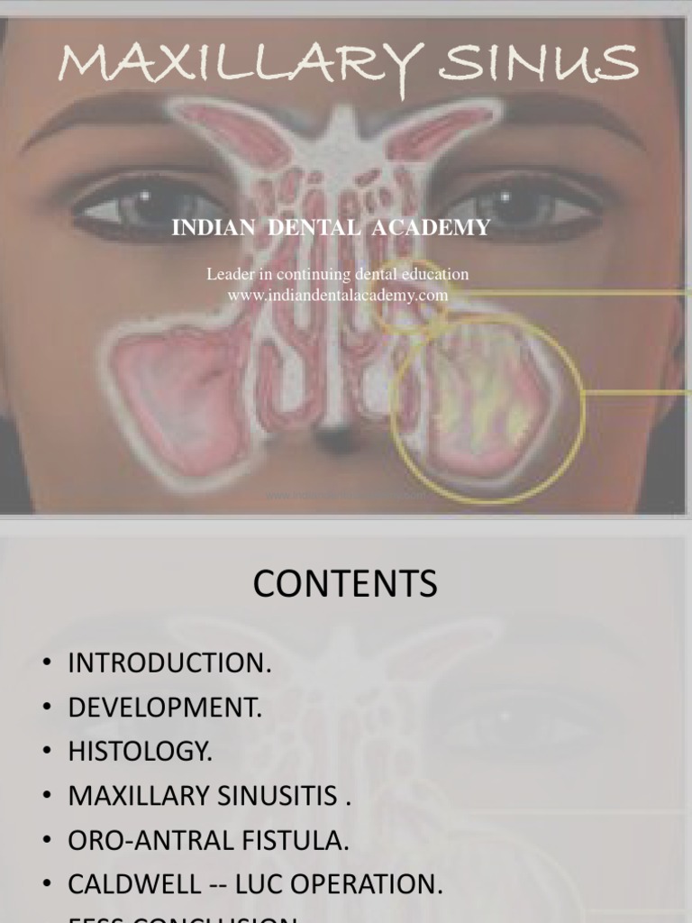 Maxillary Sinus / Orthodontic Courses by Indian Dental Academy PDF