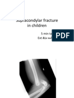 Supracondylar Fracture