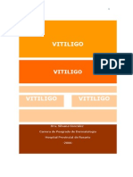 Vitiligo