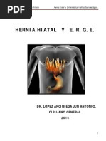 Download - Hernia Hiatal Trabajo by drjala60 SN225193602 doc pdf
