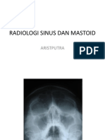 Radiologi Sinus Dan Mastoid
