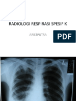 Radiologi Respirasi Spesifik