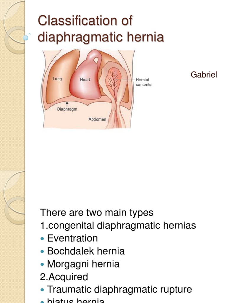 Diaphragmatic Hernias Medical Specialties Gastroenterology