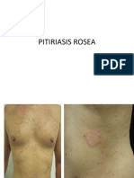 PITIRIASIS ROSEA Presentase