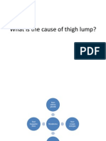 What Is The Cause of Thigh Lump