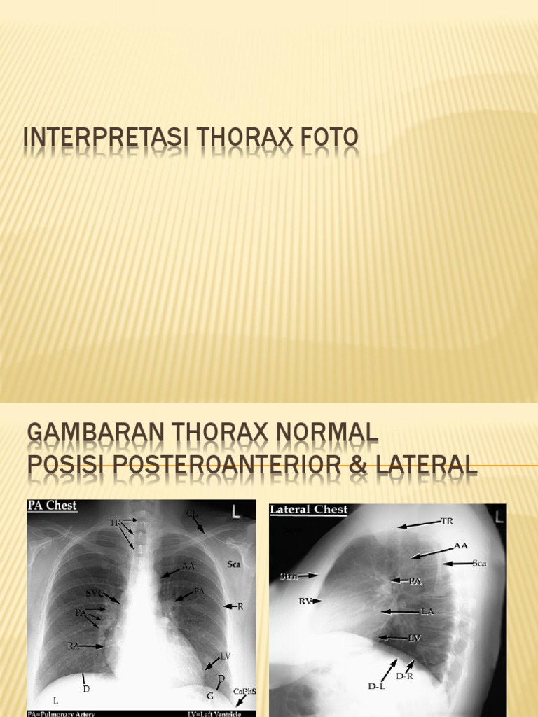 Interpretasi Foto Thorax Normal | PDF | Thorax | Musculoskeletal System