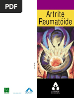 ARTRITE REUMATÓIDE