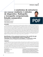 Identificacion Anatomica de Estructuras Del Maxilar Mediante 2 Metodos de Diagnostico