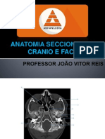 Anatomia Seccional - Cranio - III