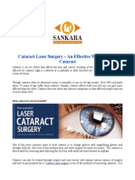 Cataract Laser Surgery - An Effective Way To Treat Cataract