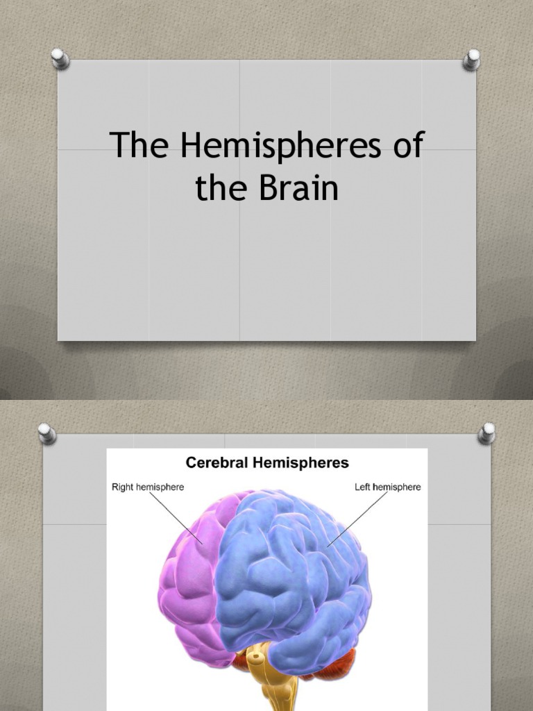 Brain Hemispheres and Their Functions | PDF | Lateralization Of Brain ...
