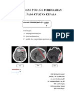 Perhitungan Volume Perdarahan Otak Pada Ct