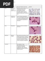 Alterações Eritrocitárias
