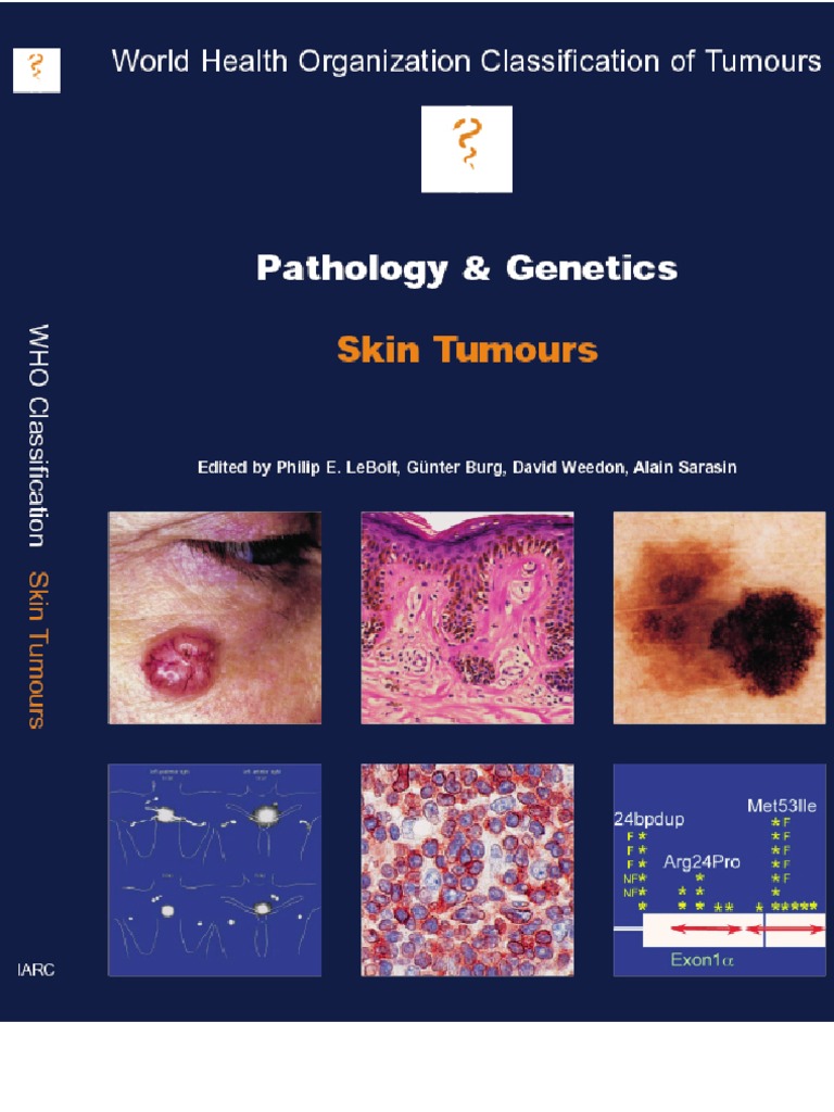 Skin Tumors Carcinoma Skin Cancer