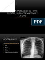 Anatomía Radiológica de Tórax