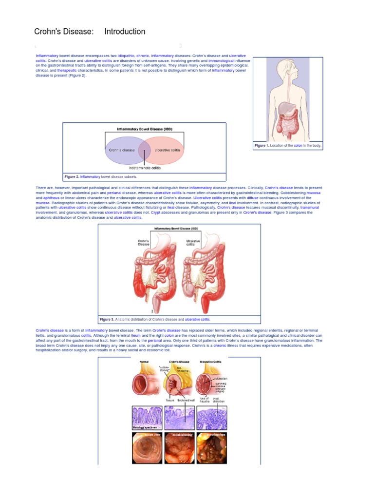 Crohns Disease Crohn's Disease Colonoscopy