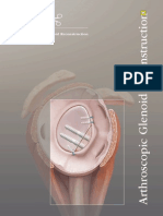 Arthroscopic Glenoid Reconstruction