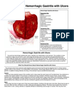 Hemorrhagic Gastritis Ulcers en