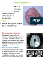 Edema Cerebral Diapositiva