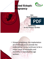Suspected Ectopic Pregnancy Bhasa Inggris2