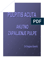 Pulpitis acuta