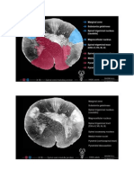 Spinal Cord Medulla Junction