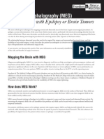 Pds Magnetoencephalography Meg