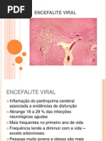 Encefalite Viral