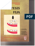 Manual de Procedimientos Clinicos. Protesis Fija – David Loza Fernandez.www.FREELIBROS.com