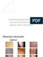 Pityriasis Versicolor, Difteri, AIDS