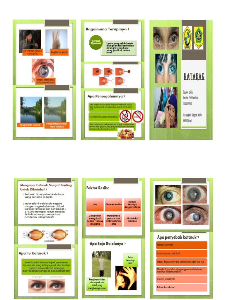 Leaflet Katarak