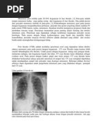 Download Metastasis Paru Lengkap by mankyudi SN228122523 doc pdf