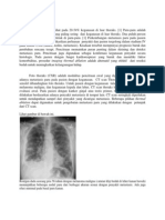 Metastasis Paru Lengkap