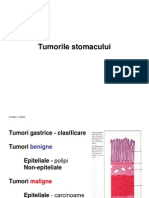 SRP - Tumori Stomac - Curs 5