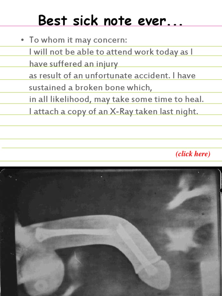 Sample Sick Note for Injury | PDF