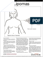 Lipomas: Typical Sites of Lipomas
