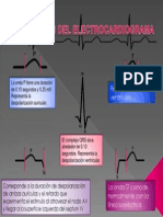 Componentes Del Ekg