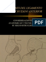 Ligamento Cruzado Anterior