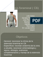 Estenosis Foraminal c6