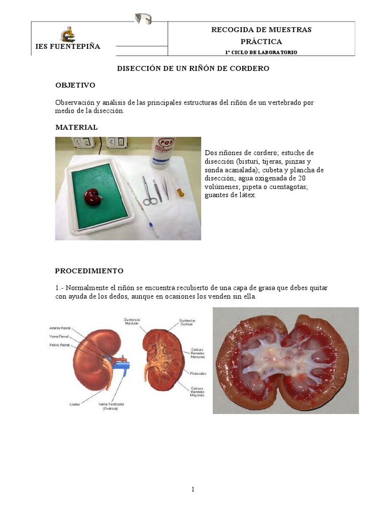 Diseccion Riñon | PDF