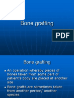 Bone Grafting