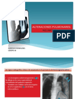 Alteraciones Pulmonares